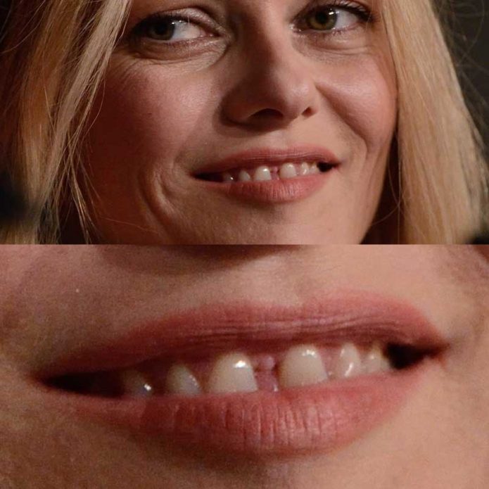 Dientes de Vanessa Paradis