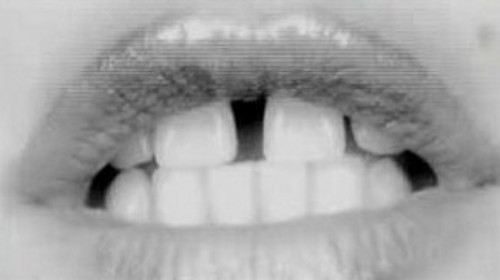Dientes de Vanessa Paradis