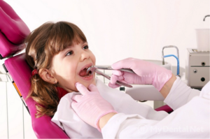 Matices de remoción de dientes dañados en niños.