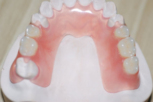 Tecnología de fabricación de prótesis dentales.