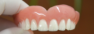 Implantes dentales