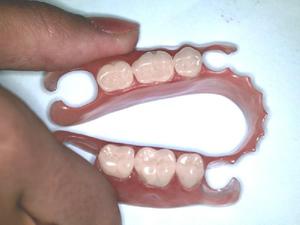 Implantes dentales de nueva generación.
