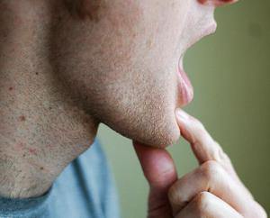 Dolor en la mandíbula en la oreja izquierda.