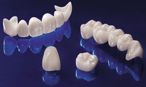 Cerámica sin metal en odontología - opciones para coronas