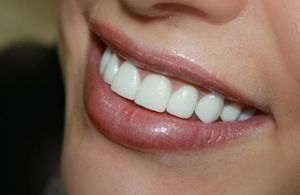 Las coronas en los dientes pueden parecer naturales.