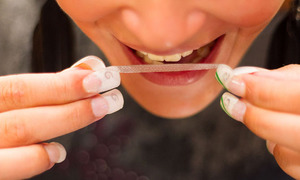 Métodos de blanqueamiento dental.