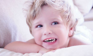 Causas posibles de crujir de dientes