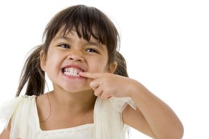 Causas del rechinamiento de dientes en niños.