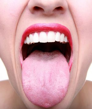 Tratamiento de la placa en la lengua.
