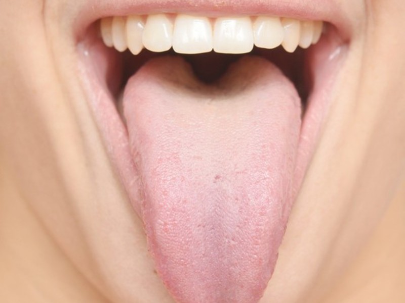 Cubierta de la lengua ¿Por qué hay una incursión en la lengua?