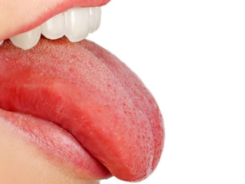Raid en la lengua Limpieza de la lengua