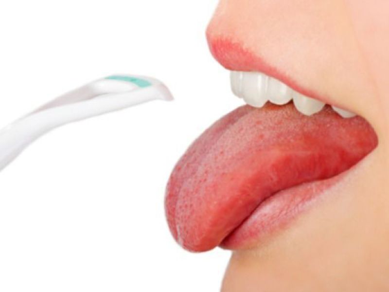 Como remover la placa de la lengua. ¿Qué significa eliminar la placa en el idioma?