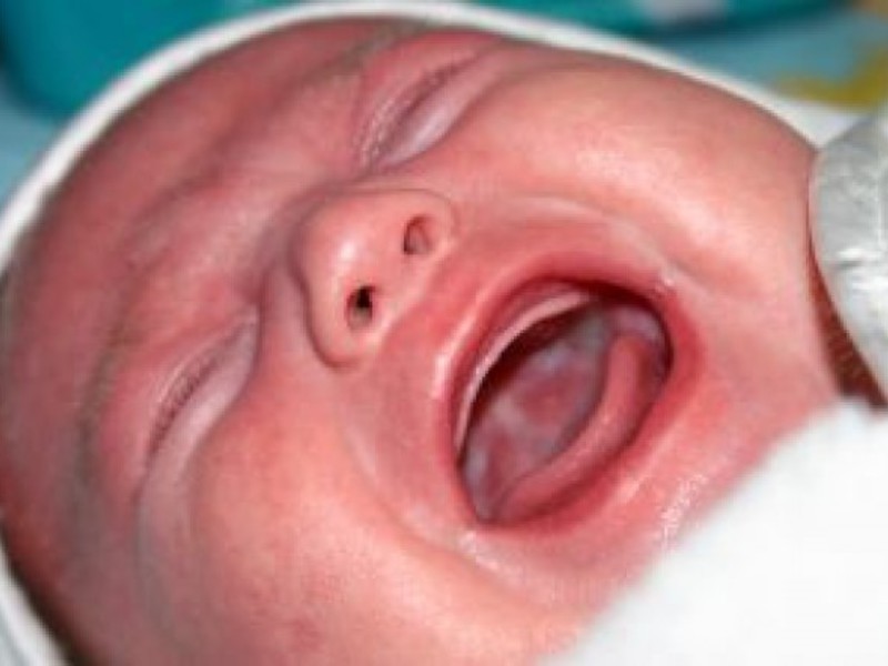 Cómo curar la candidiasis