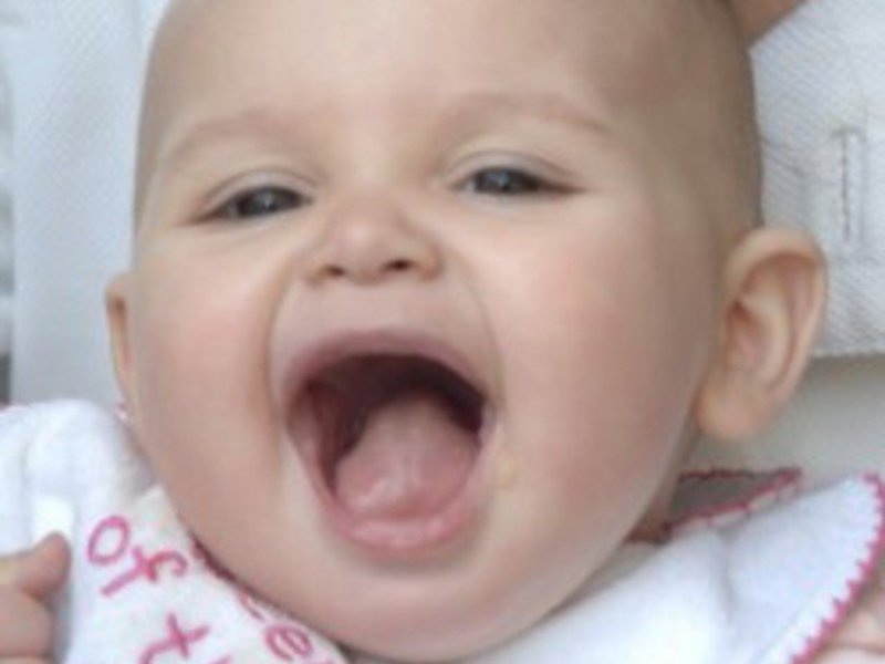 Como ser si el bebe tiene zorzal.