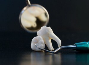 Odontología Moscú, donde puedes sacar una muela del juicio.