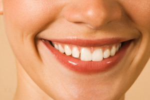 Características de la implantación de dientes llave en mano.