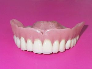 La vida útil de las dentaduras de silicona.