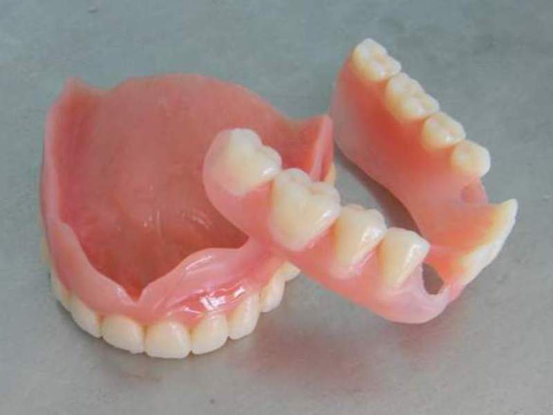 Instalación de prótesis de silicona.