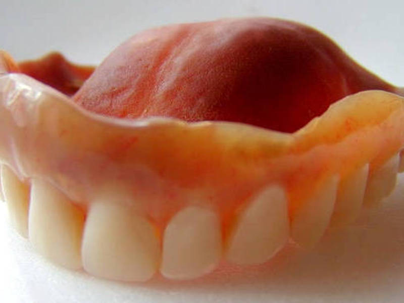 Técnicas de fabricación de dentaduras de silicona.