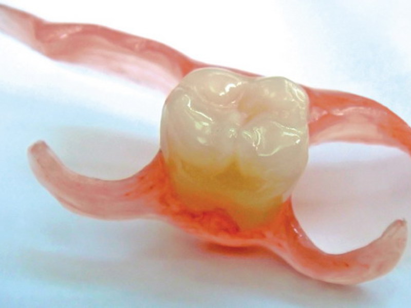 Desventajas de las dentaduras de silicona
