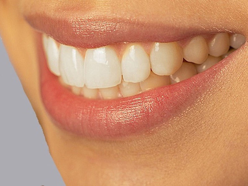 El proceso de instalación de dentaduras de silicona.