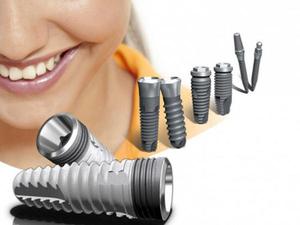 Implantes de tornillo