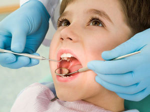 Pulpitis dientes de leche