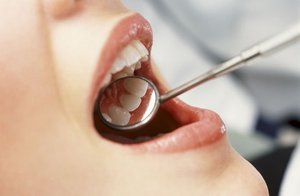 Las causas más frecuentes de un absceso en las encías.