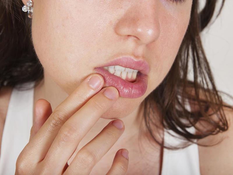 ¿Qué condiciones conducen al desarrollo del herpes en los labios? Listado de condiciones que contribuyen a la formación del herpes.