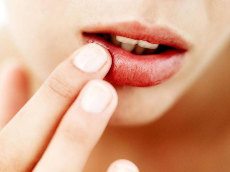 ¿Cuáles son algunos signos de herpes? Descripción de los signos de la enfermedad viral de los labios.